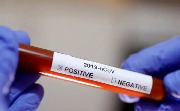 DANGER ZONE JALANDHAR : आज 7 नए केस के बाद जालंधर में 2 और रिपोर्ट CORONA POSITIVE DC – लोग घबराएं नहीं, ज्यादा टेस्ट होने के कारण सामने आ रहे केस corona positive congress mla