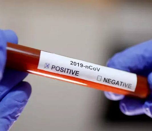 corona positive congress mla