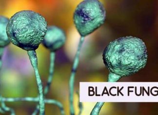 JALANDHAR BLACK FUNGUS ATTACK 21 рдорд░реАрдЬ рд░рд┐рдкреЛрд░реНрдЯ; рд╕рд┐рд╡рд┐рд▓ рдЕрд╕реНрдкрддрд╛рд▓ рдореЗрдВ рдирд╣реАрдВ рд╣реИ рдЗрд▓рд╛рдЬ black-fungus jalandhar
