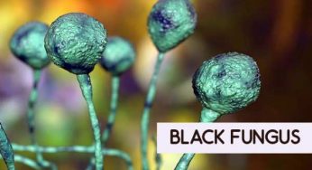 JALANDHAR BLACK FUNGUS ATTACK 21 मरीज रिपोर्ट; सिविल अस्पताल में नहीं है इलाज